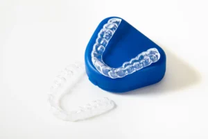 Whitestone Clear Aligners: Smile Correction Kerala