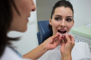 smile correction in Kerala