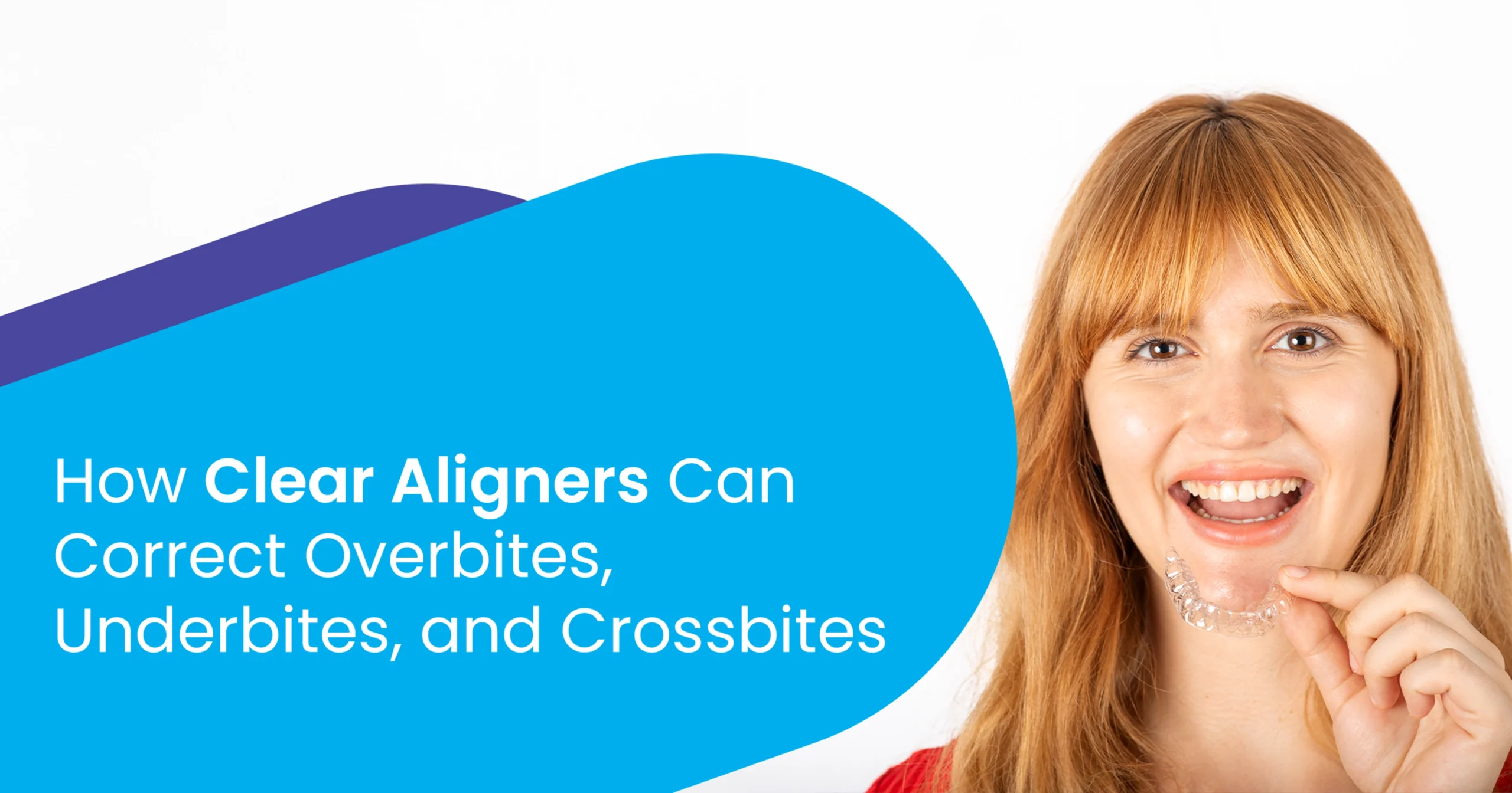 How Clear Aligners can Correct Overbites, Underbites and Crossbites