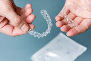 White Stone Clear Aligners product kit in Kerala