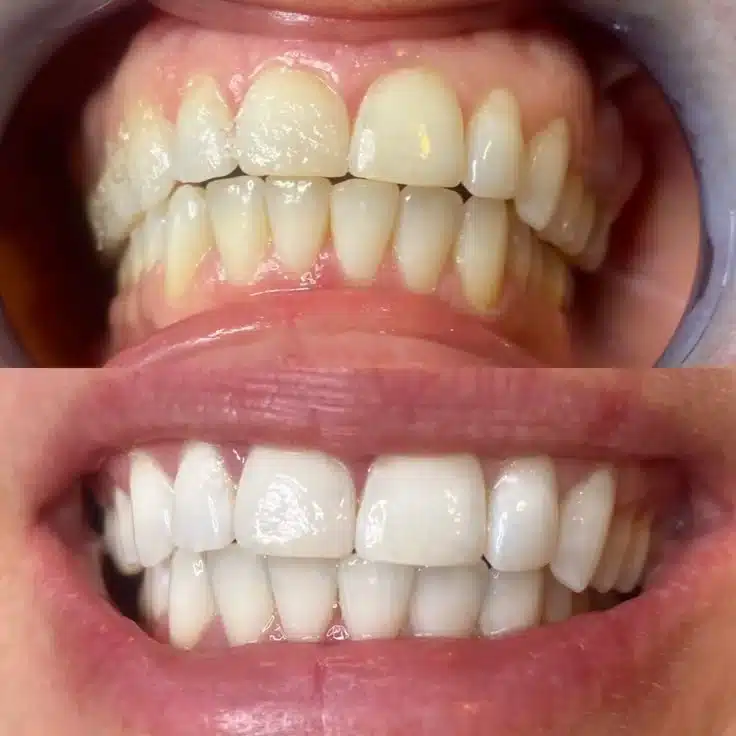 Why Actual Treatment Takes Longer Than Promised