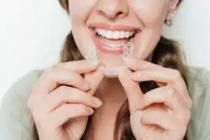 How Clear Aligners Fix Crowded Teeth