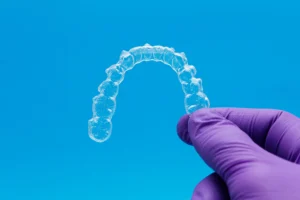 What Are Clear Aligners