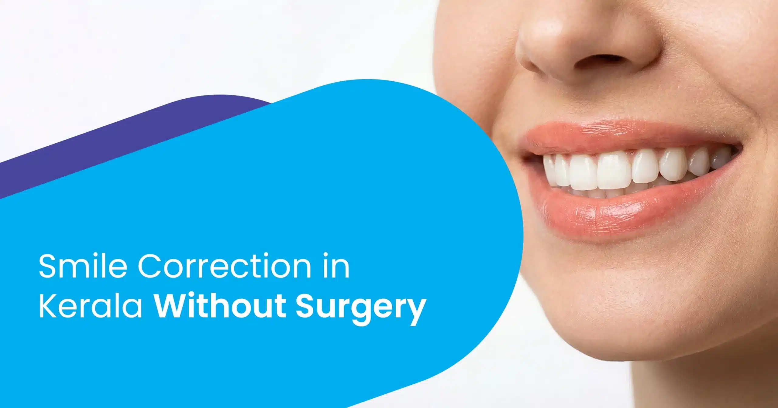 Smile Correction in Kerala Without Surgery