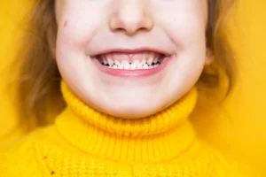 What Is Malocclusion