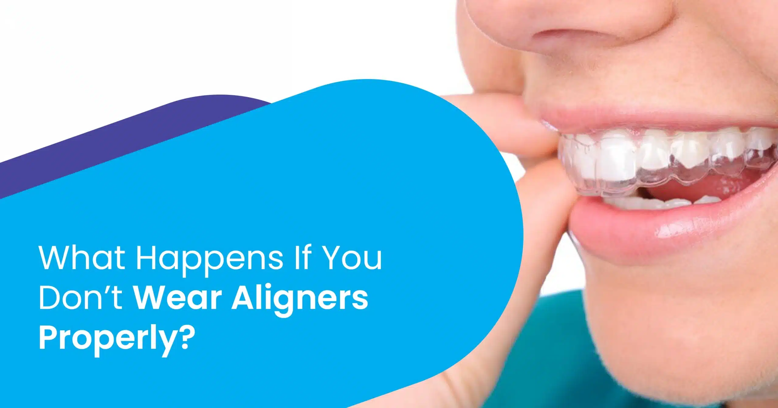 Not wearing aligners properly