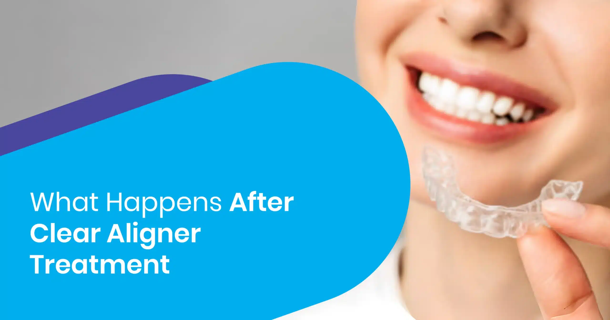 After Clear Aligner Treatment