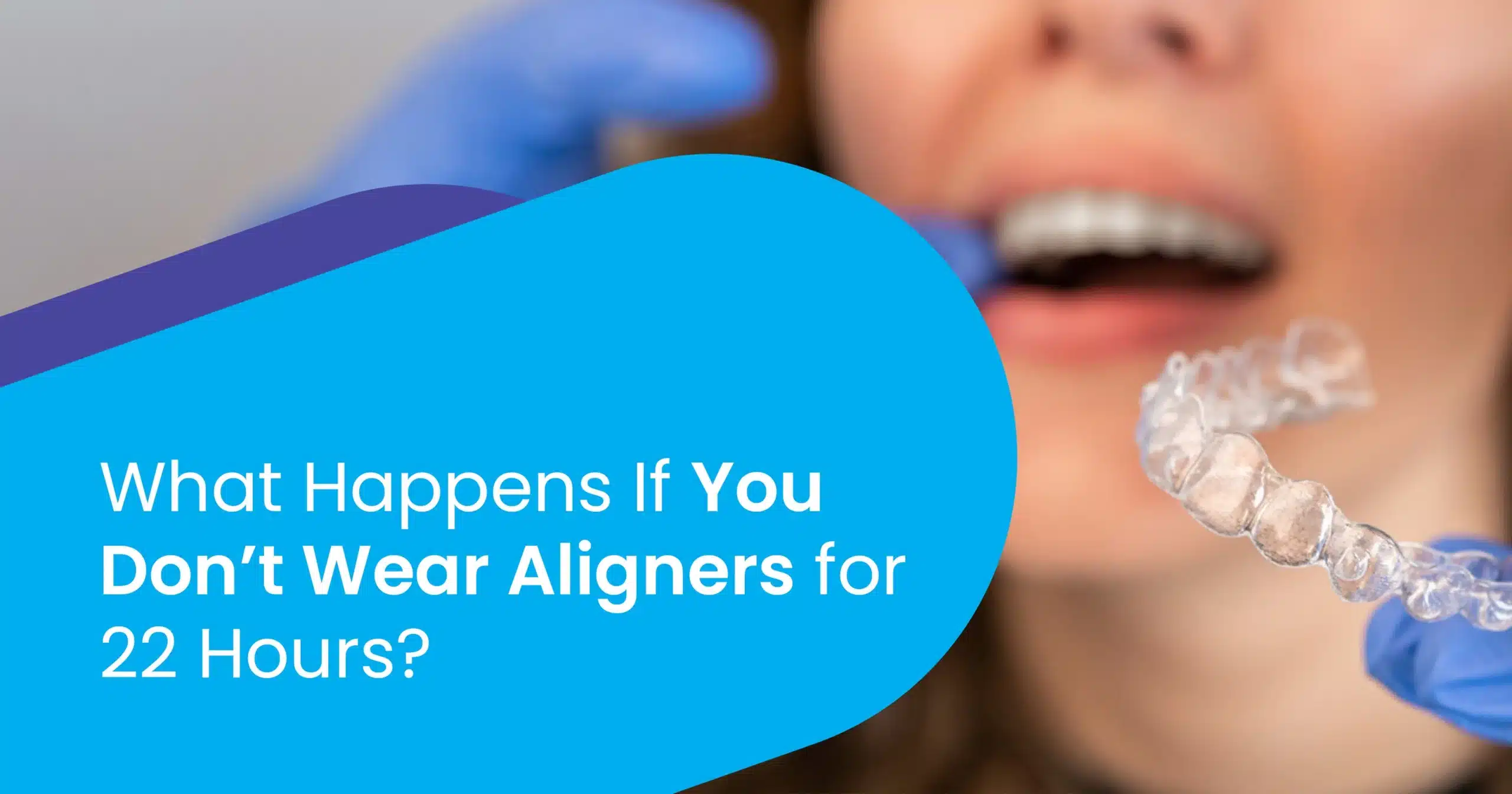 Clear Aligners Wear Time