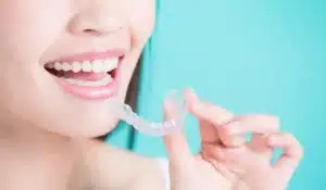 Benefit from Clear Aligners