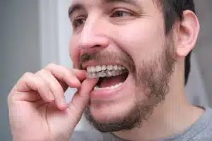 Clear Aligners Side Effects Beyond Speech