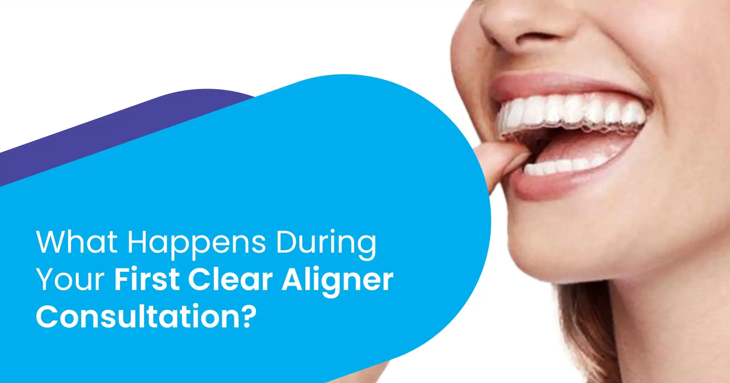 First Clear Aligner Consultation
