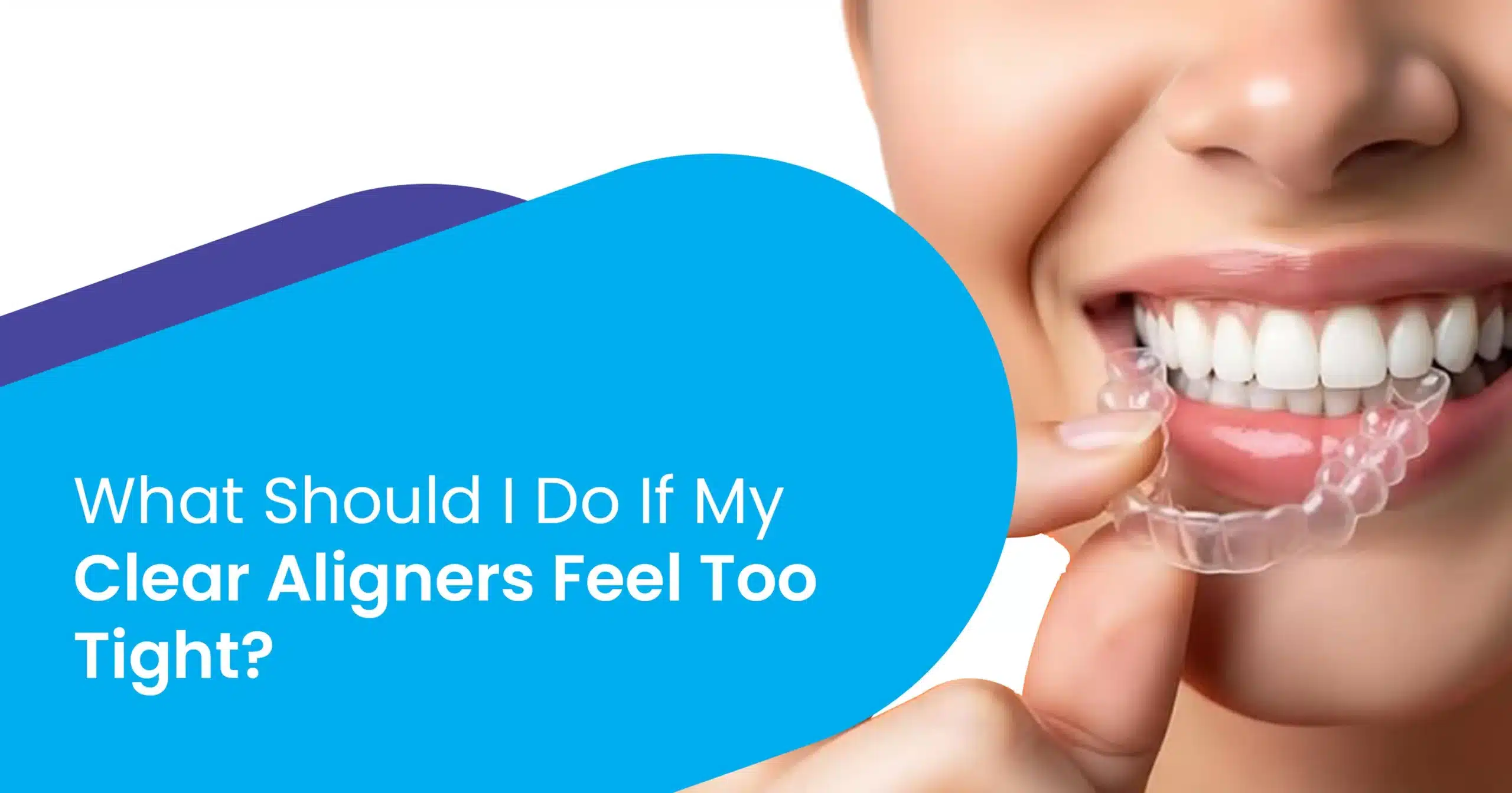 Clear Aligners Feel Too Tight