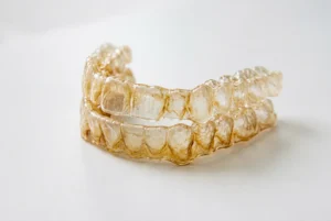 Why Are My Clear Aligners Turning Yellow