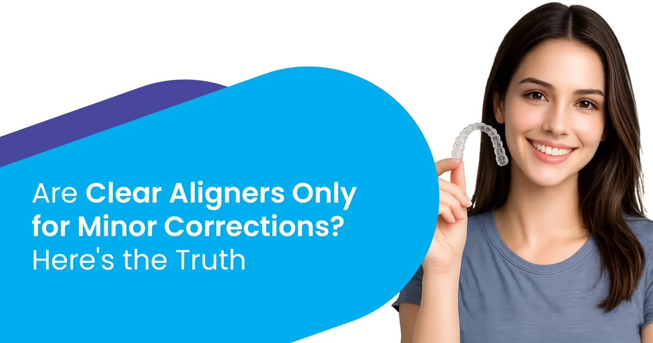 Clear Aligners Only for Minor Corrections