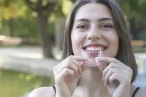 Clear Aligners Fix a Deep Bite