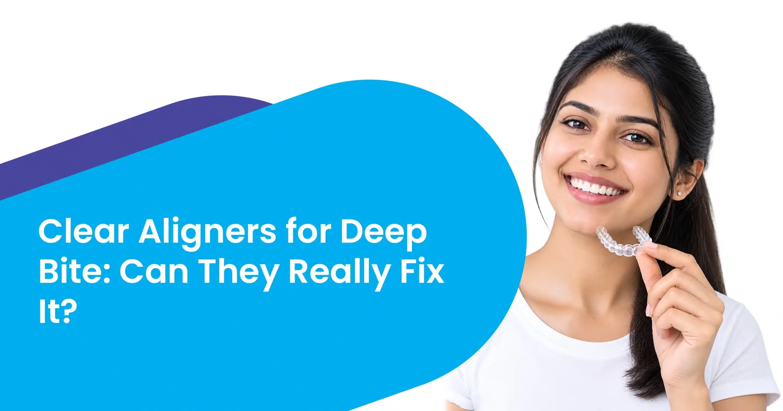 Clear Aligners for Deep Bite