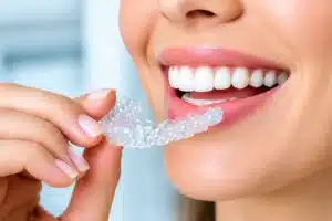 Are Clear Aligners After Braces a Second Chance for Your Smile